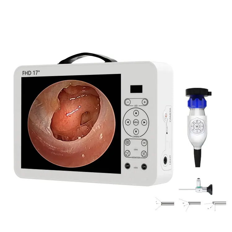 Sistema de Diagnóstico ORL con - Medical Lab Images reseña y precio